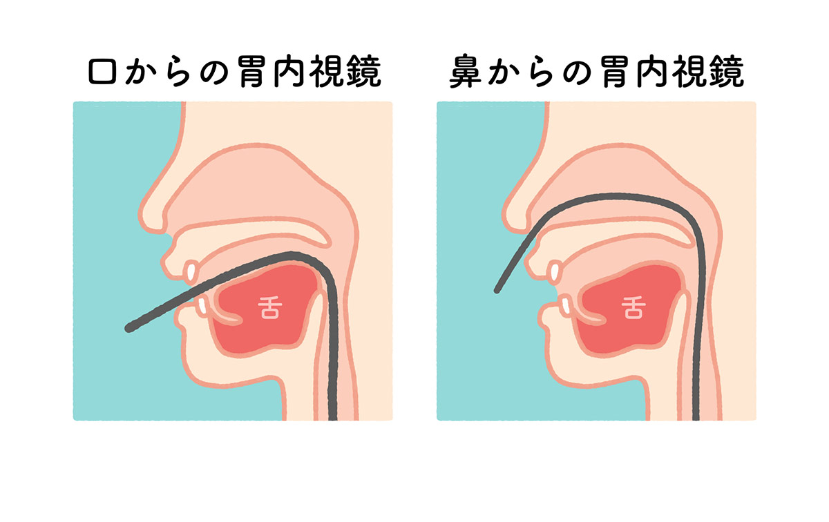 当院の内視鏡検査の特徴